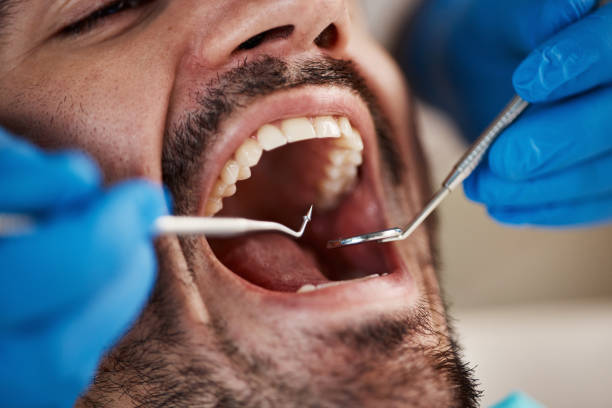 Best Emergency Dental Filling Replacement  in Sonora, CA